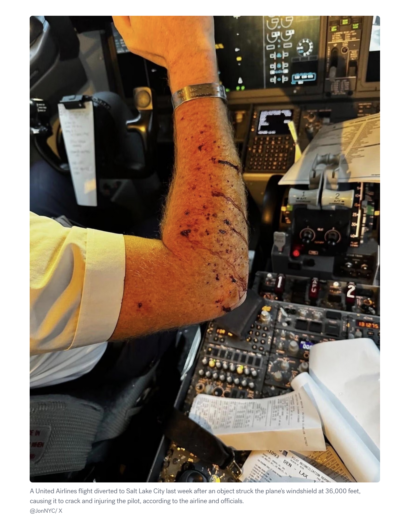 Pilot with cut arm from glass shards